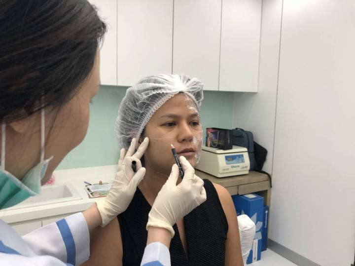 caanteen ulthera isky center52