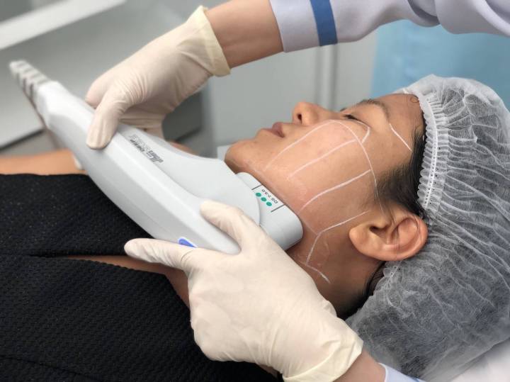 caanteen ulthera isky center55